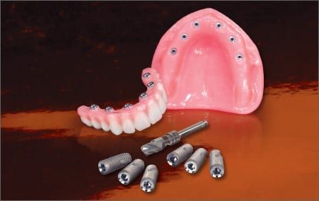 inclusive trs screw retained hybrid