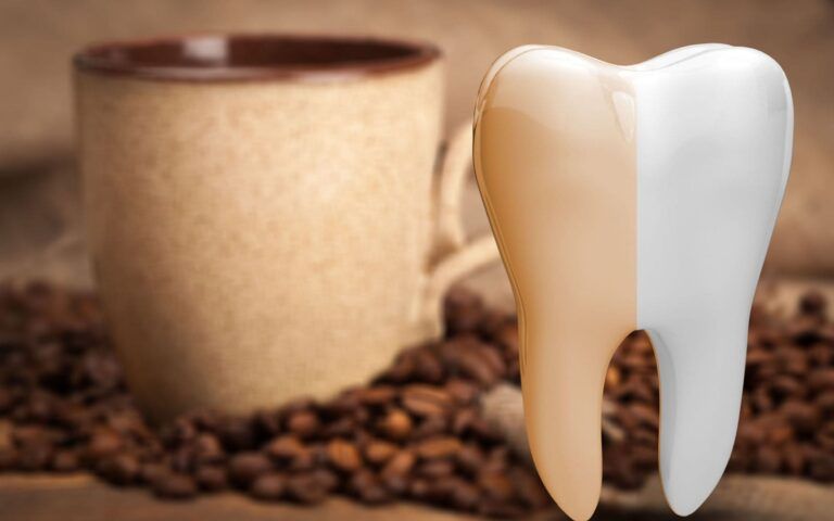 Teeth Stained By Coffee