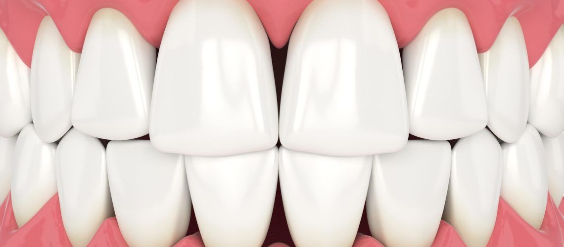 Dental Triangles