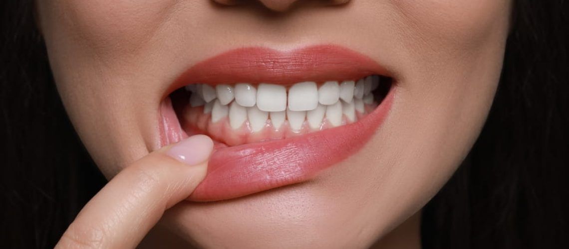 Young woman showing healthy gums, closeup view